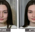 How to Remove Imperfections From Photos? 12 How to Remove Imperfections From Photos? 11