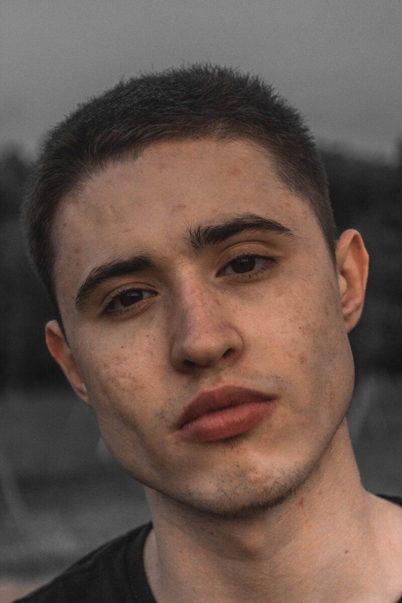 How Long Does It Take For Curology To Work? 2 acne