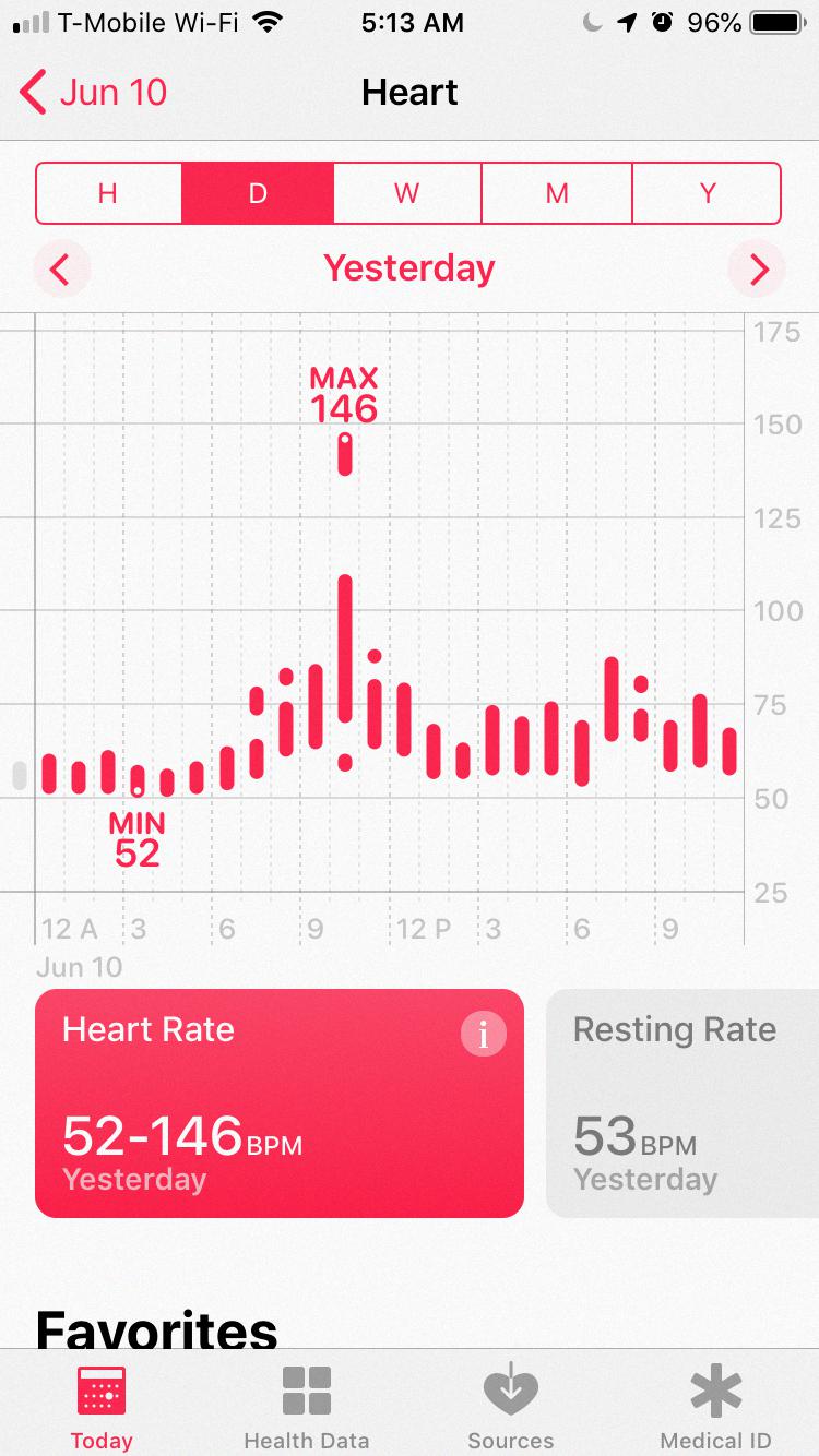 apple watch heart rate spikes apple watch heart rate spikes