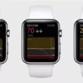 How Dexcom G6 Direct Brings CGM to Your Apple Watch 2 How Dexcom G6 Direct Brings CGM to Your Apple Watch 1
