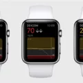 How Dexcom G6 Direct Brings CGM to Your Apple Watch 7