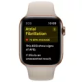 How to Disable ECG on Your Apple Watch 13