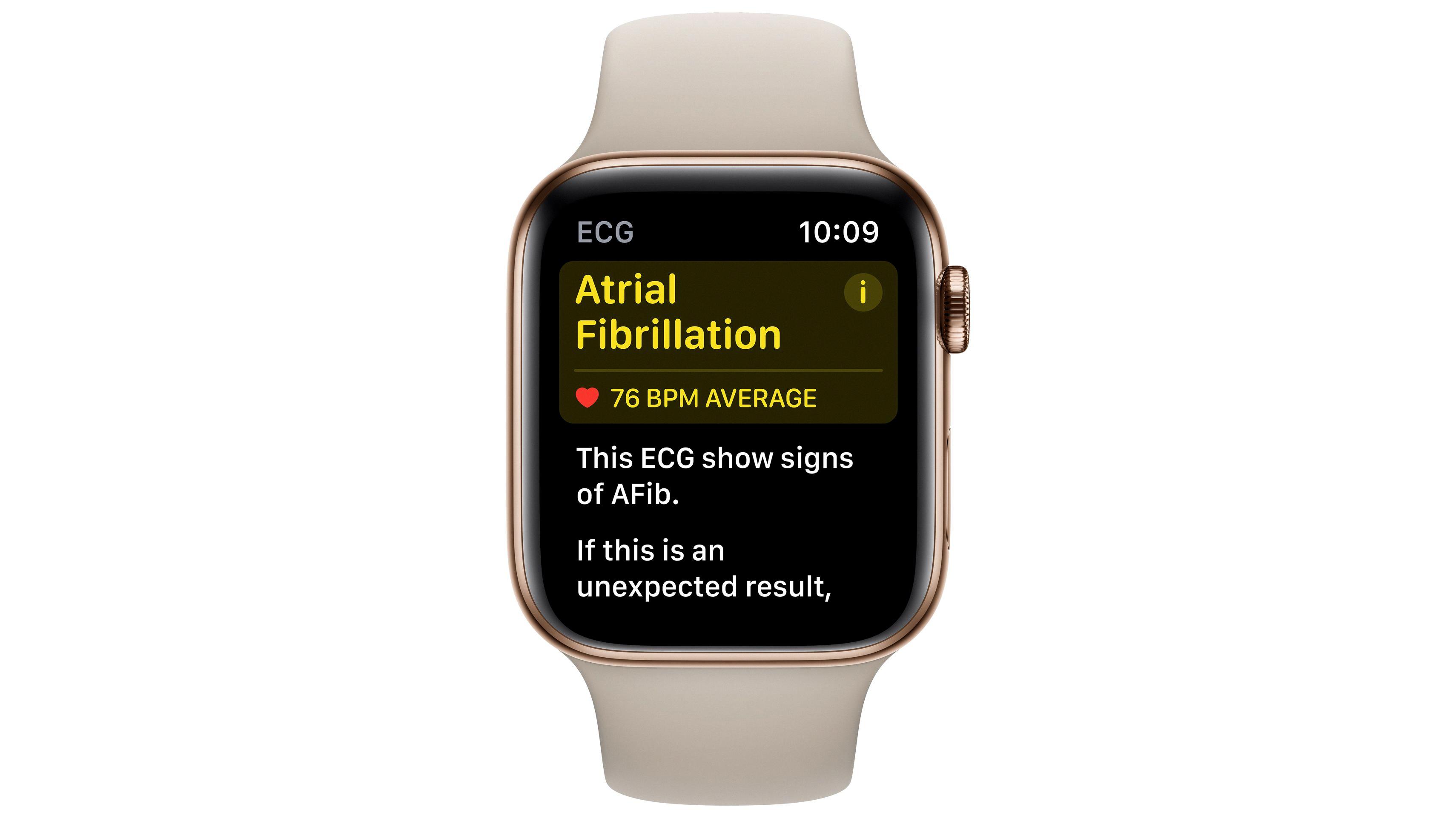 How to Disable ECG on Your Apple Watch 7