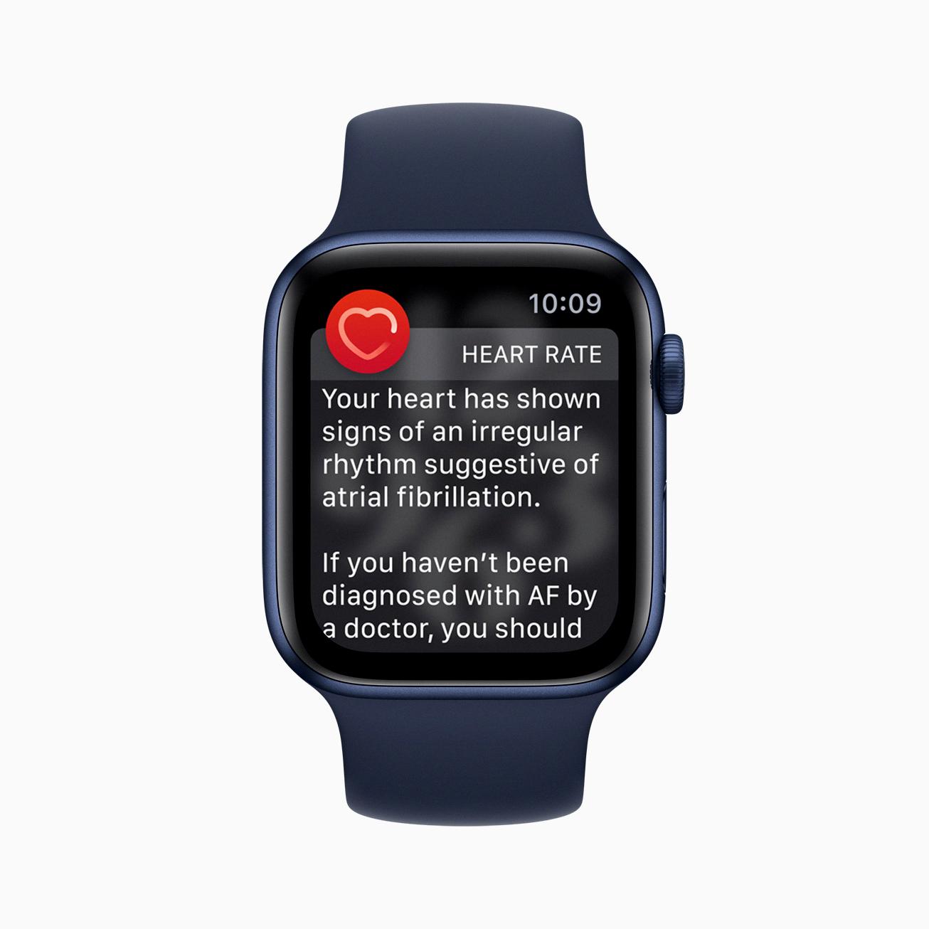 How to Disable ECG on Your Apple Watch DeviceMAG