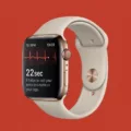 Troubleshooting ECG App Not Working on Your Apple Watch 4 5