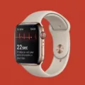 Troubleshooting ECG App Not Working on Your Apple Watch 4 9