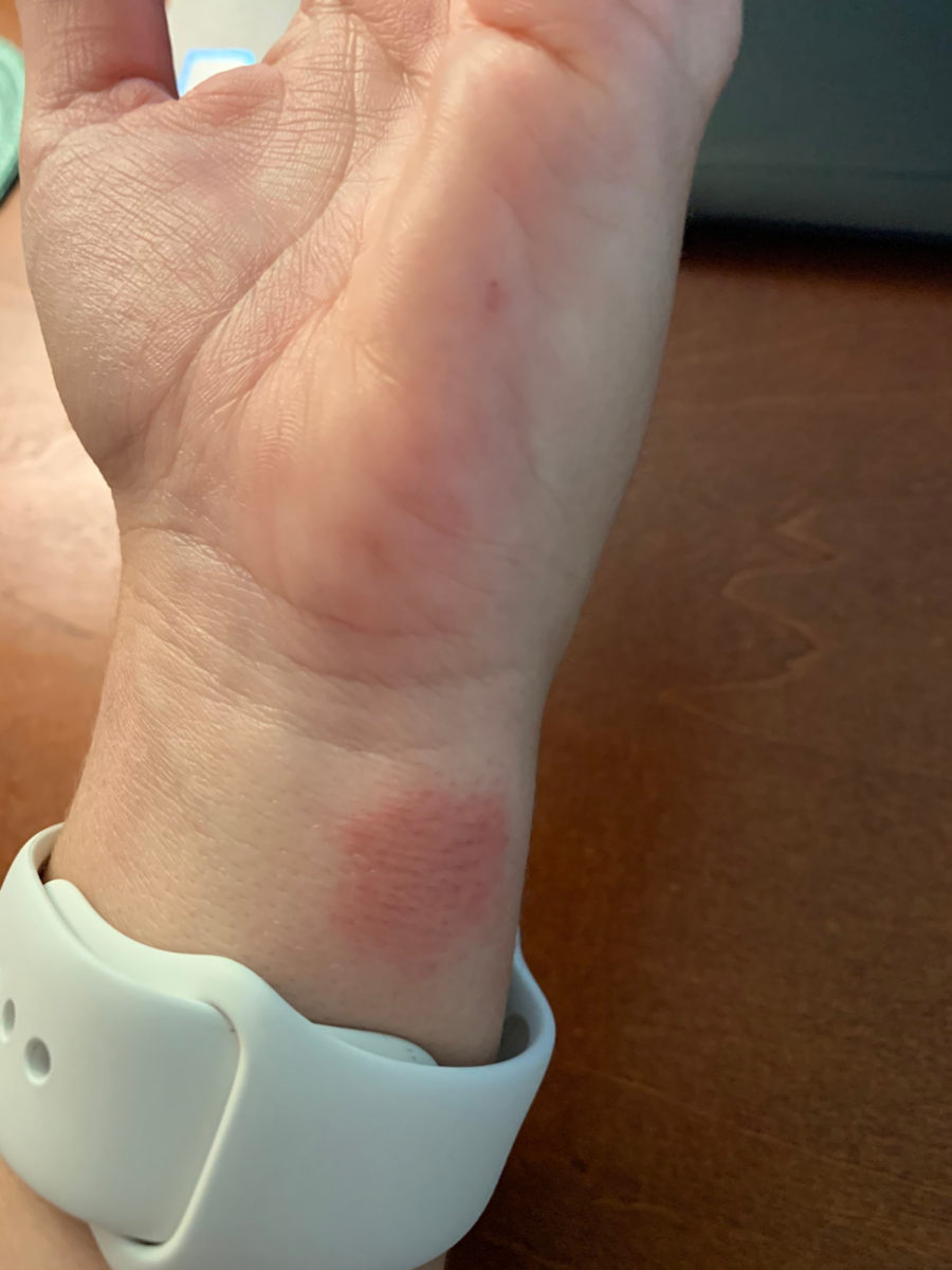 The Best Apple Watch Bands to Prevent Rash 3