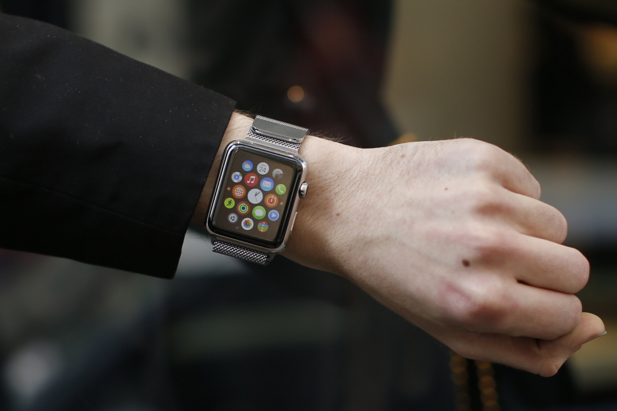The Best Apple Watch Bands to Prevent Rash 1