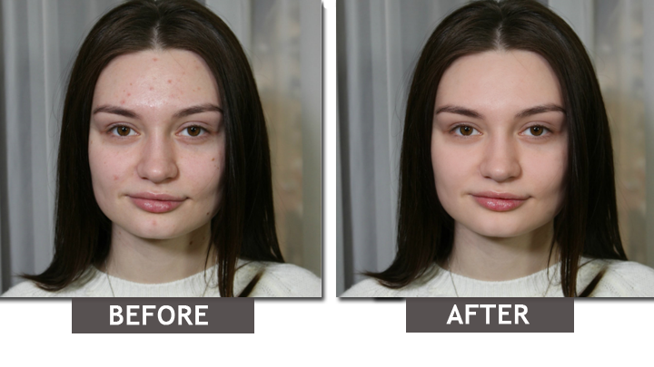 How to Remove Imperfections From Photos? 2 How to Remove Imperfections From Photos? 1
