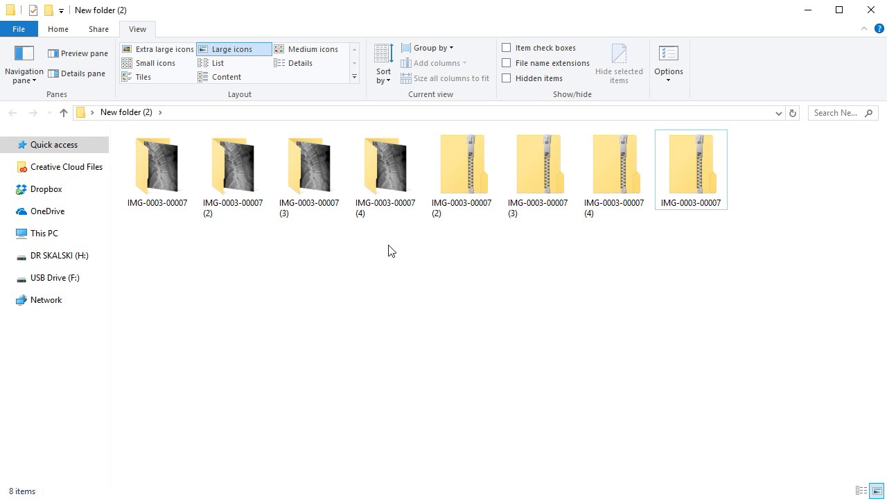 How to Extract Multiple Zip Files at Once? 2 How to Extract Multiple Zip Files at Once? 1